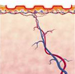 汽化雷射加裝光閘