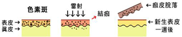 表淺的色素